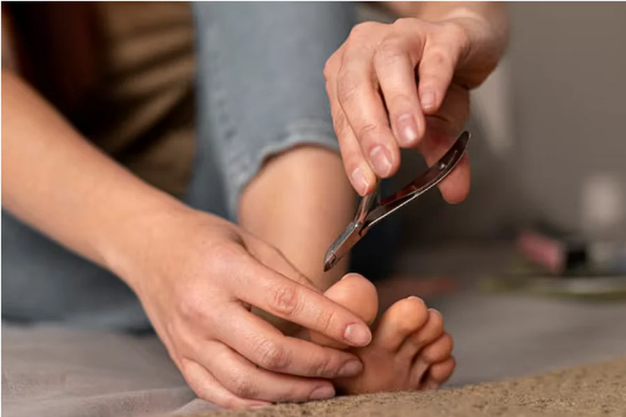 Nail Treatment